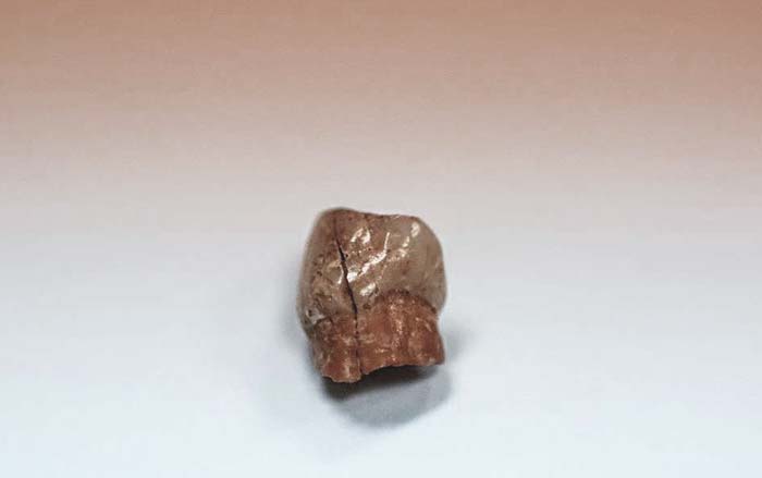 دندان نئاندرتال